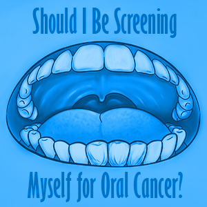 Whalen Dentistry explain the basics on oral cancer self exams