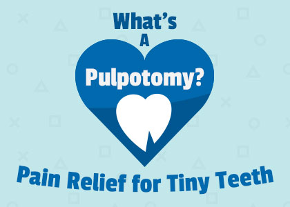 Cornelius dentist, Dr. Ryan Whalen of Whalen Dentistry, explains what a pulpotomy is, when they’re recommended, and the steps of the procedure for saving baby teeth.