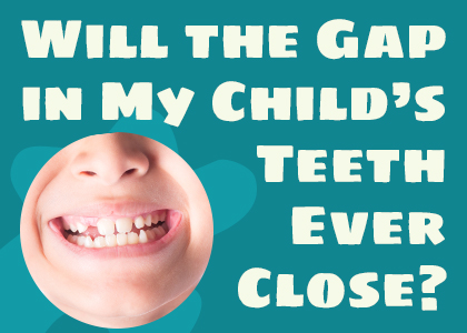 Cornelius dentist Dr. Ryan Whalen of Whalen Dentistry talks about potential causes and treatments for gapped teeth in children.