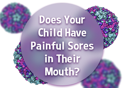 Cornelius dentist, Dr. Ryan Whalen at Whalen Dentistry tells parents about a common viral infection that may present with sores in your child’s mouth.