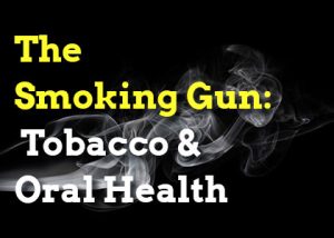 Cornelius dentist, Dr. Whalen at Whalen Dentistry, explains why tobacco use including smoking and chewing is terrible for oral and overall health.