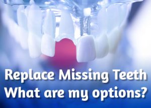 Cornelius dentist, Dr. Whalen at Whalen Dentistry, discusses the tooth replacement options available to replace missing teeth and restore your smile.