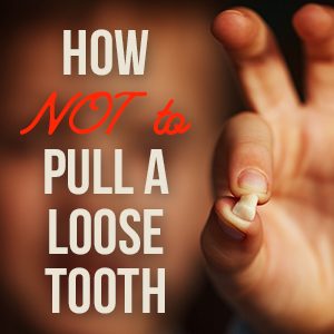 Cornelius dentist, Dr. Ryan Whalen at Whalen Dentistry, tells parents the do’s and don’ts of pulling your child’s loose baby teeth for the safest and most painless experience.