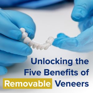 Seeking a non-invasive smile makeover? Learn about the benefits of removable veneers from Cornelius' dentist, Dr. Ryan Whalen at Whalen Dentistry.