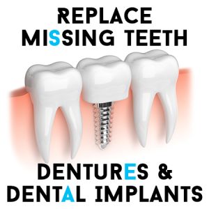 Cornelius' dentist, Dr. Ryan Whalen at Whalen Dentistry, tells patients about the benefits of replacing missing teeth with dentures and dental implants.