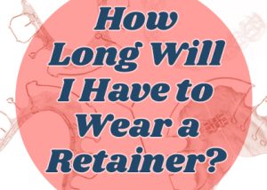Cornelius' dentist, Dr. Ryan Whalen at Whalen Dentistry, discusses how long a retainer should be worn after orthodontic treatment.