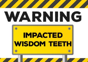 Cornelius' dentist, Dr. Ryan Whalen at Whalen Dentistry, explains what signs might mean you have impacted wisdom teeth and if you might need them extracted.