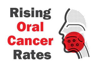 Cornelius' dentist, Dr. Ryan Whalen at Whalen Dentistry, talks about the process of screening for oral cancer as diagnosis rates are on the rise.